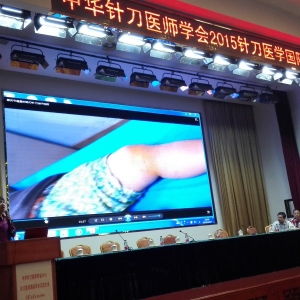 2015中华针刀医师学会针刀医学国际学术交流大会，王学昌主任学术报告 ...