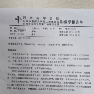 chiari颅脑畸形，不一定都需要手术