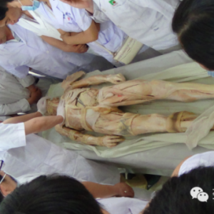 股外侧皮神经变异——解剖标本及临床探讨