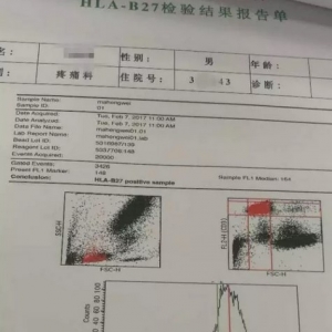 弧刃针标准疗法治疗强直性脊柱炎的典型病例分享