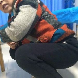 弧刃针标准疗法治疗左膝关节骨性关节炎的典型病例