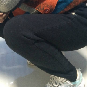 一例弧刃针标准疗法治疗膝骨关节炎“难以下蹲” 典型病例分享 ...