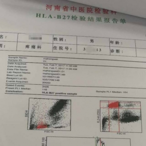 弧刃针标准疗法治疗假性“终板炎”