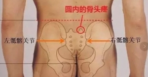 尸体解剖：骶髂关节解剖结构