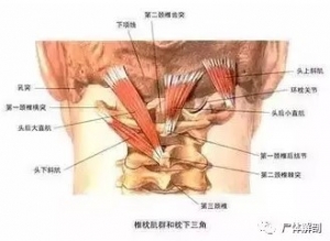 尸体解剖——枕下小肌群(椎枕肌)