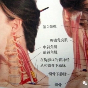尸体解剖——颈前外侧肌
