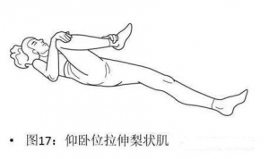 常坐硬板凳警惕坐骨神经痛小心梨状肌综合征