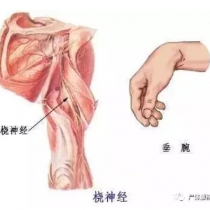 尸体解剖——桡神经