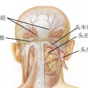 针刀松解治疗偏头痛的方法（头部神经卡压是主要原因）