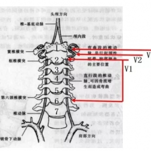 尸体解剖——椎动脉分段