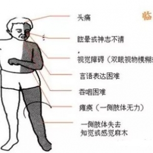 经常手指发麻是什么原因造成的?