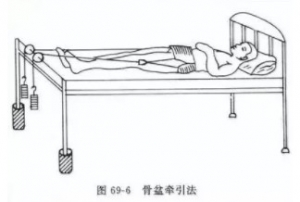 腰椎间盘突出症患者保守治疗方案有哪些?