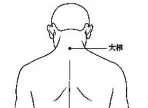 艾灸大椎穴的作用与主治疾病