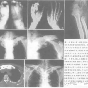 这种罕见疼痛，很多人没有听说过（结合病例介绍）