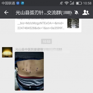 颈肩腰腿痛培训精华班学员分享：腰疼患者弧刃针治疗后活动自如 ...