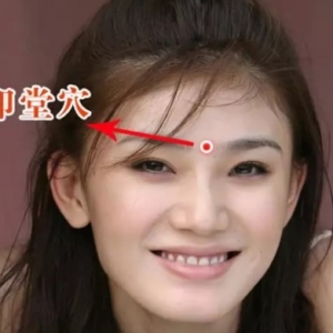 颈肩腰腿痛网：针灸治疗面瘫的穴位介绍