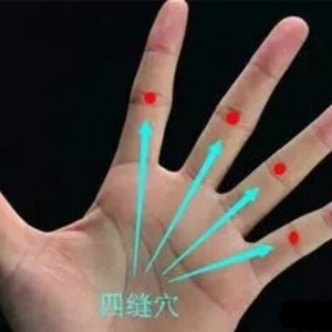 除了治疳积，四缝穴还能治很多疾病
