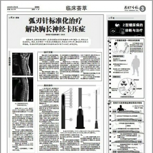 弧刃针标准化治疗解决胸长神经卡压症