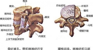 椎管狭窄症临床表现有哪些?