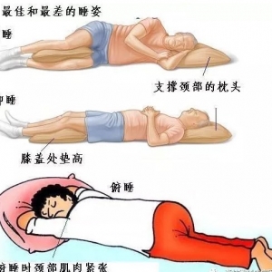 腰间盘突出症要注意睡姿，选择对腰好的睡姿很重要