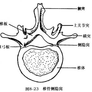 腰椎间盘突出症患者的侧隐窝处理