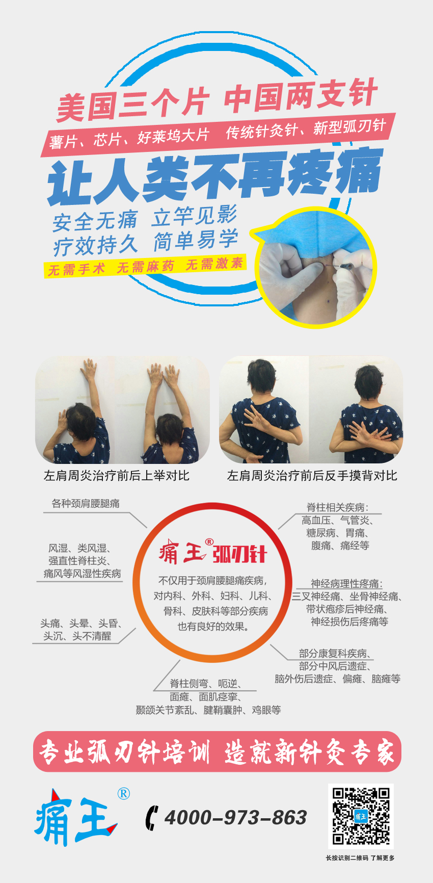 中国新针灸——弧刃针专题班