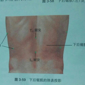 下后锯肌损伤腰痛，两例典型病案分享